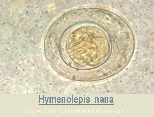 Hymenolepis nana egg image