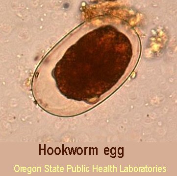 hook worm egg